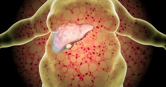 Fegato grasso: un’epidemia silenziosa in rapida crescita